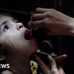 Polio cases surge in Pakistan ahead of vaccination campaign