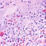 A Person in Arizona Has Died From Plague. Who’s Most at Risk of Contracting It, and How Can You Protect Yourself?