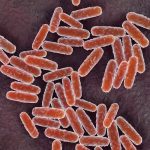 A California Resident Tests Positive for Plague. What to Know About the Disease