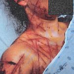 Ex-Republican staffer, 26, found hogtied & mutilated in ‘fake anti-Trump attack’ ordered to get mental health treatment