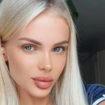 Glam model, 33, left fighting for life after vanishing for two weeks & suffering brutal beating requiring brain surgery